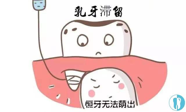 乳牙滞留，恒牙无法萌出