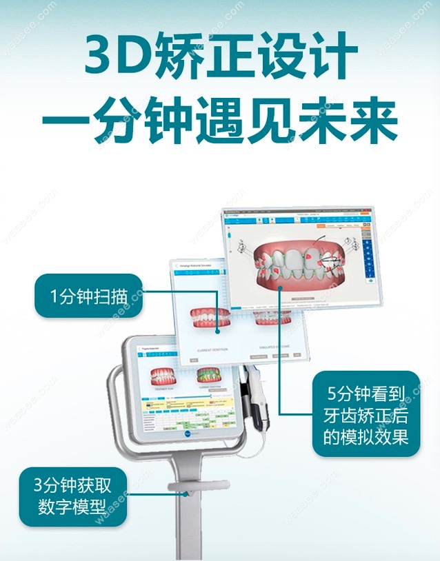 itero口扫仪.png