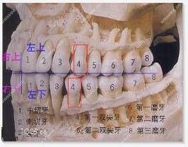 正畸拔牙一般都拔的哪4颗牙，拔的过程疼吗
